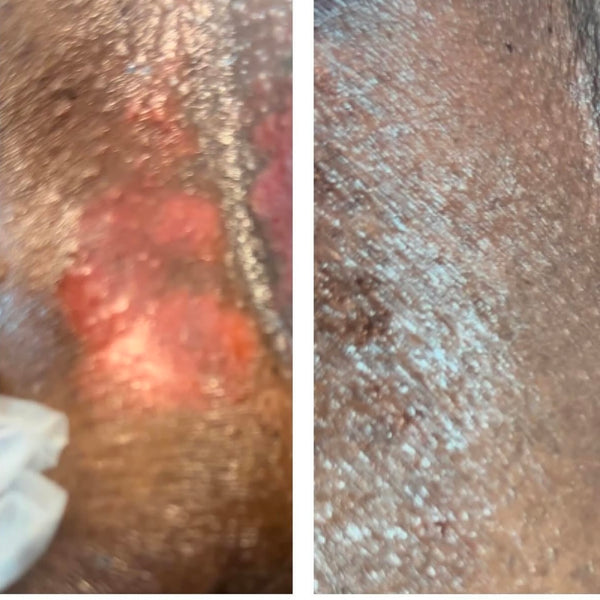 CRACKS & CREVICES SKIN REPAIR - UNSCENTED